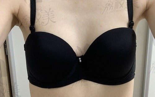 手术前