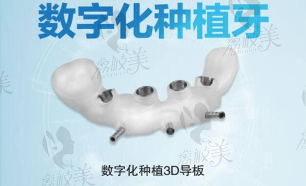广州穗华口腔医院人工智能数字化种植牙，半口\全口种植牙更轻松