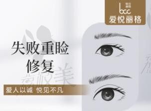 北京爱悦丽格马力修复眼睛技术不错,马力M-双眼皮修复价格33830元起