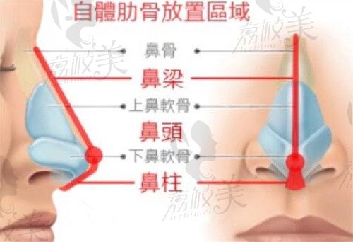 李萍和周顺波谁做鼻子更好,高人气医生技术附带真实反馈！