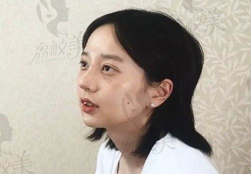 手术后
