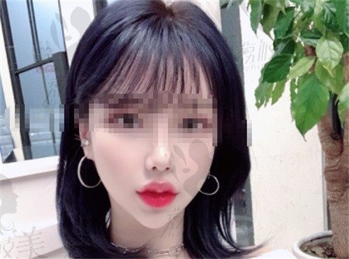 手术后