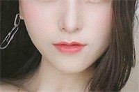 找成都李运峰做下颌角排队半年多,好在术后消肿快也没二次角