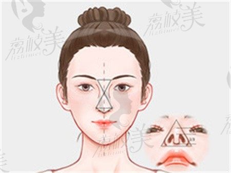 杭州温科磊鼻子做的怎么样？温科磊和张龙做鼻子谁厉害？