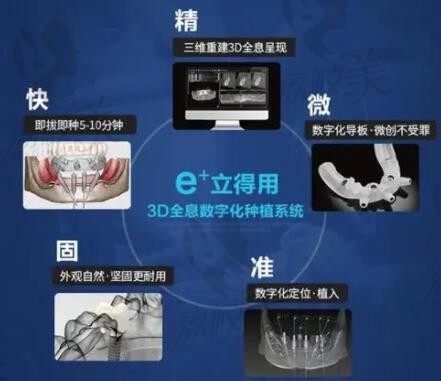 北京中诺口腔医院全口种植牙价格表更新，e+立得用数字化种植牙有保障