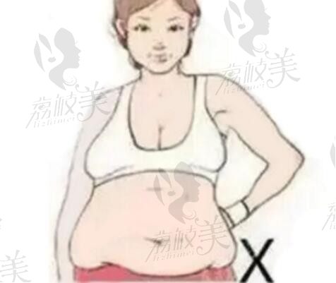 杭州腰腹吸脂好的医生中，郭同荣和彭涛、马腾哪个吸脂技术更好？