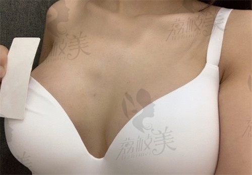 手术后
