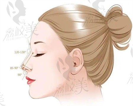 杭州吴艾竞做鼻子技术确实好，半肋鼻综合术后自然可揉捏3W起可做