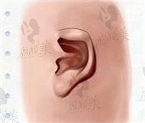 康春雨杯状耳畸形矫正18600元起,6岁后就能手术还不留疤