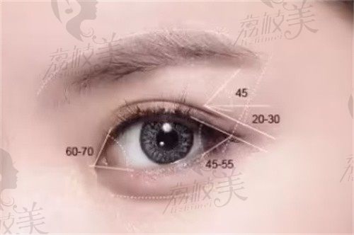 西安艺星宋蔚医生双眼皮修复技术超赞，6D眼综合修复1.5w起