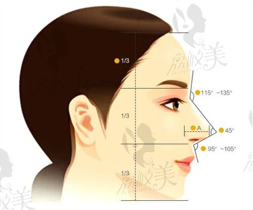 西安艺星陈天杰做鼻整形好自然，BSK综合隆鼻2W起全面修复鼻形态