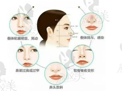 上海华美做鼻修复怎么样？李健医生和张朋医生谁做鼻子技术更好？