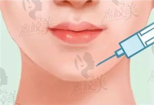 2022上海垫下巴整形医院排名已公开，排行前十的整下巴技术真厉害