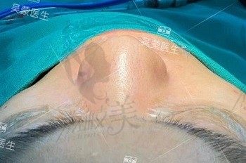 手术前