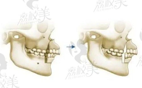 上海时光医疗整形做正颌怎么样？何晋龙正颌/双鄂手术起价105728元