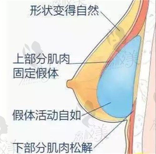 中韩做乳房再造术出名的医生都有谁,精选柳济圣/李相达/曾昂等！