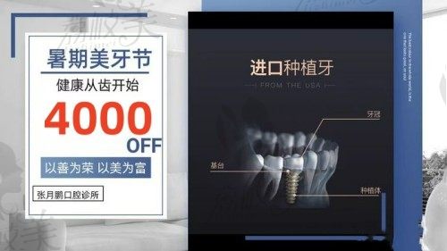 牡丹江张月鹏口腔种牙价格更新，韩国进口植体才4000元起