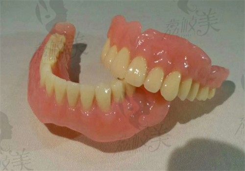 吸附性义齿和种植牙哪个好？分析两者区别看看更直观