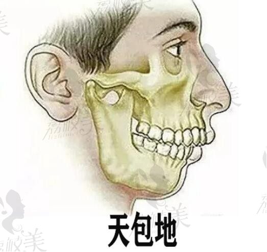 广州广大医院何锦泉医生做正颌手术价格5万起，上下鄂/凸嘴矫正很擅长