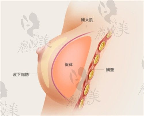 韩国THE整形医院做乳房再造价格8万起，玉在镇院长做隆胸修复很擅长