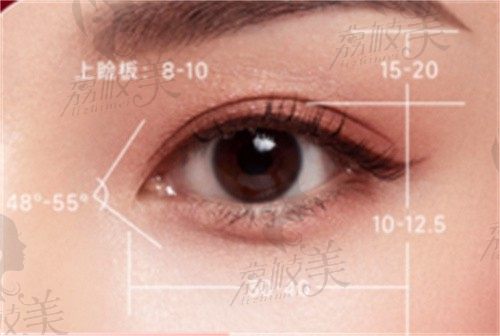 杭州艺星2023双眼皮综合整形攻略在此，并有人气口碑医生推荐