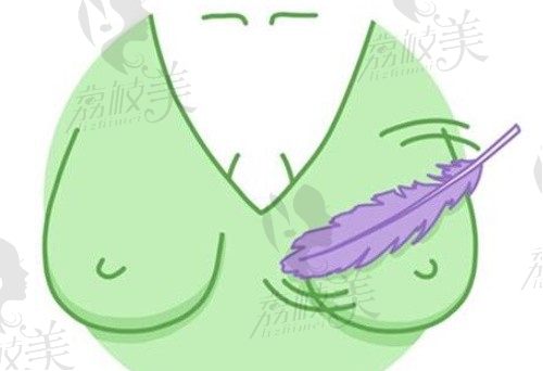 广州紫馨整形乳房下垂矫正价格3.8万起，尹卫东医生做隆胸修复很擅长