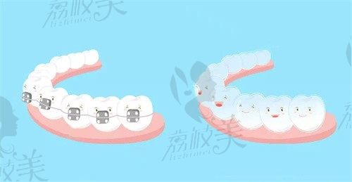 南京牙齿正畸医院排名公布：美奥/茀莱堡/金铂利口腔有上榜