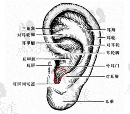 杭州整形医院做耳廓畸形缺损手术费用5万起，耳再造一期二期周期短