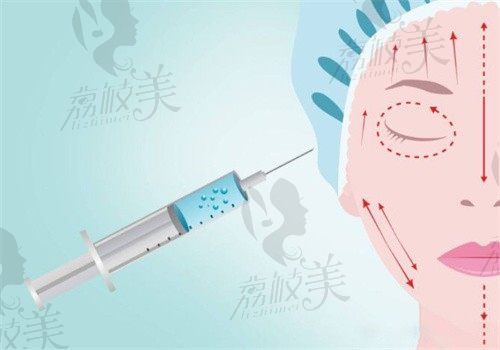 杭州艺星是玻尿酸注射正规医美机构，并有微整医生推荐及价格参考