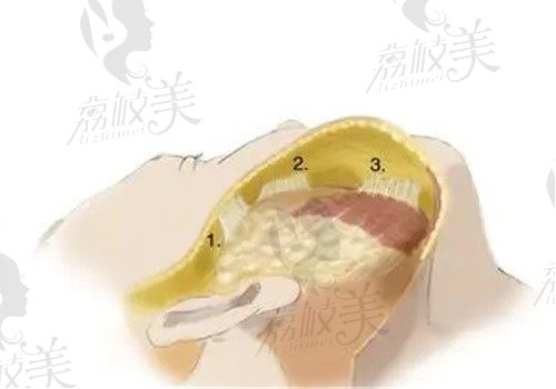广州陈兵拉皮怎么样好不好?参考陈兵医生做小切口拉皮技术和价格