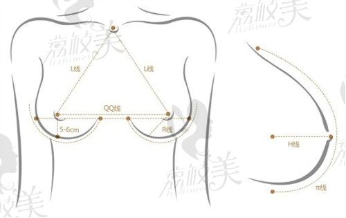 杭州复合丰胸手术医院排名公布，脂肪填充+假体隆胸自然又动感