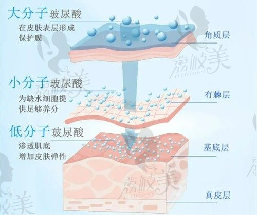 中山爱思特玻尿酸价格明细来了，快来看注射一支玻尿酸要多少钱