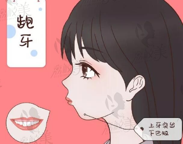 广州中家医家庭口腔医院可以做正颌，华志熙医生正畸+正颌10万起