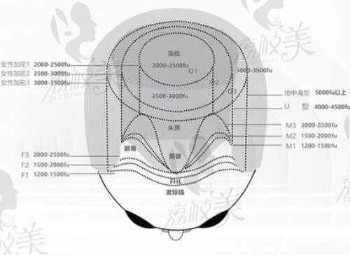 广州十大植发医院价目表:发际线植发2880元起,头顶加密植发6543元起