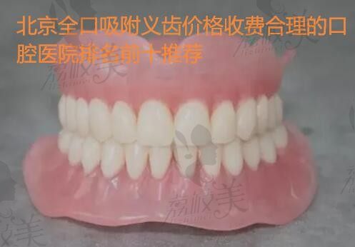 牙齿缺失多颗可以做全口吸附性义齿吗？价格及北京做的好的医院这里有