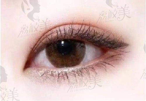 武汉王海平医生双眼皮做的好可在线预约，自然无痕眼综合1.2万元起