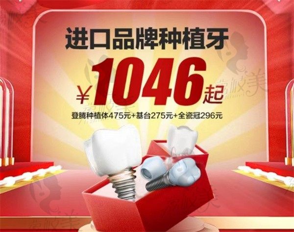 北京维乐口腔种植牙价格下降了，限时优惠活动韩国登腾集采价1046元起
