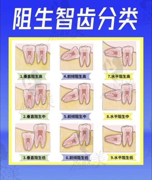 良心牙医解答什么样的智齿需要拔掉，拔完智齿脸会变小变瘦吗