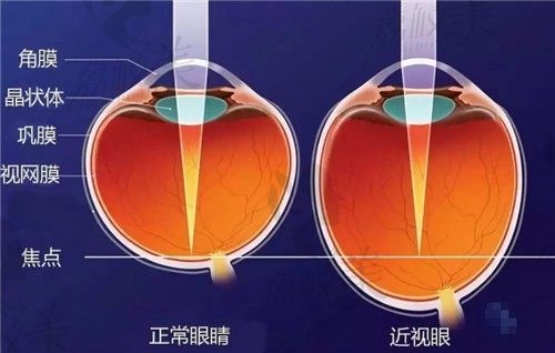 一瞧广州视百年眼科医生名单可知，视百年治近视远视老花都擅长