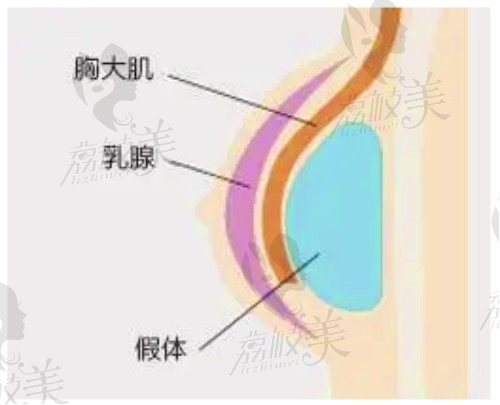 哈尔滨艺星隆胸怎么样？了解李云峰、唐龙、吴垠隆胸技术和价格