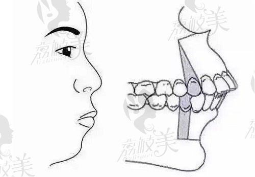 北京联合丽格双颌前突矫正推荐王瑞晨医生，资质与技术实力都很强
