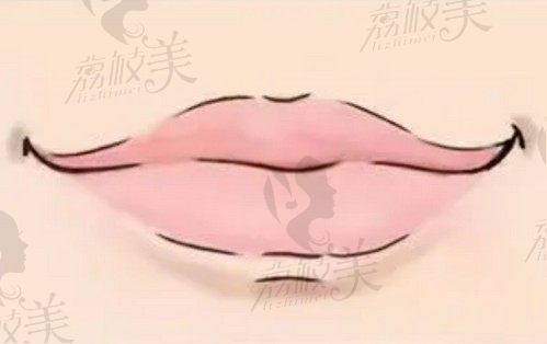 北京清木张曼医生做唇部整形技术好，嘴角上扬手术1.2W起很自然