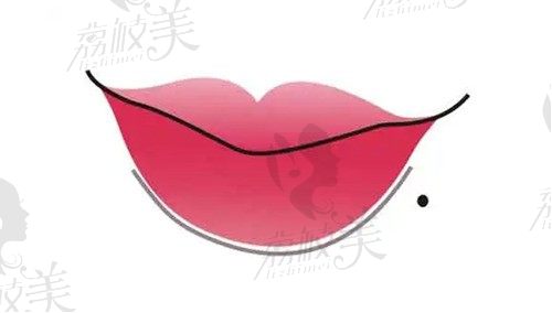 广州玻尿酸丰唇多少钱?参考广州整形医院排名前十玻尿酸丰唇价格