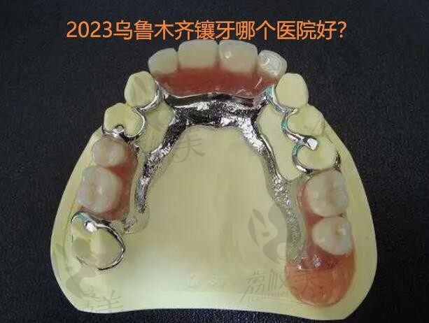 2023乌鲁木齐镶牙哪个医院好？天牙口腔等几家价格优惠口碑好