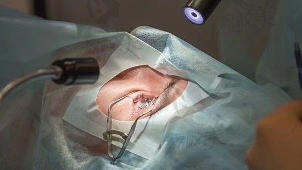 全飞秒近视眼手术最佳年龄和度数，需要多久才能恢复到正常视力呢