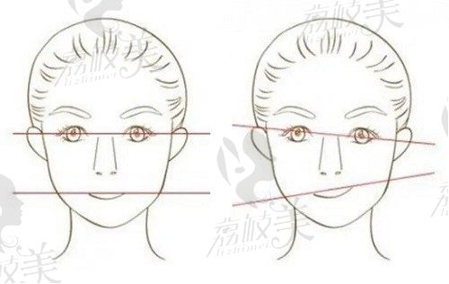 面部不对称脸歪怎么矫正？教你如何一键搞定矫正脸型不对称的方法