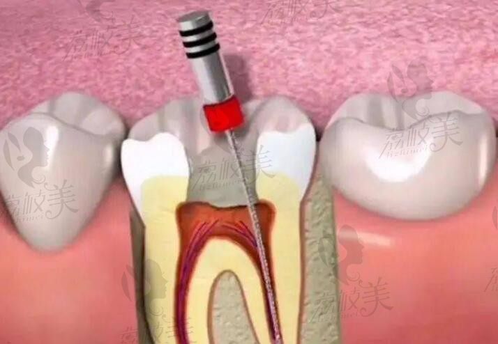 牙科在线医生免费一对一咨询，24小时免费解答种植.正畸等口腔问题