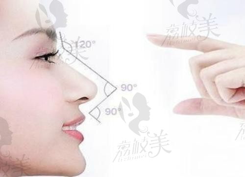 杭州艺星张龙做全肋鼻是有名的，鼻综合3项6.8w起解决鼻部问题多