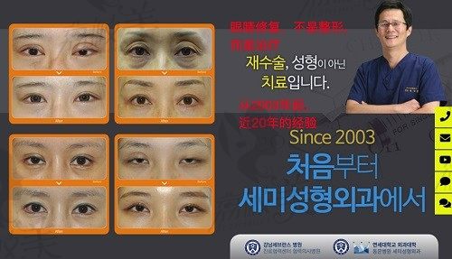 盘点韩国高难度眼修复医院，专攻各类失败眼型修复