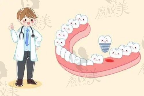 2023肇庆牙科收费价目表来瞅眼,种植牙和矫正价格一键查询